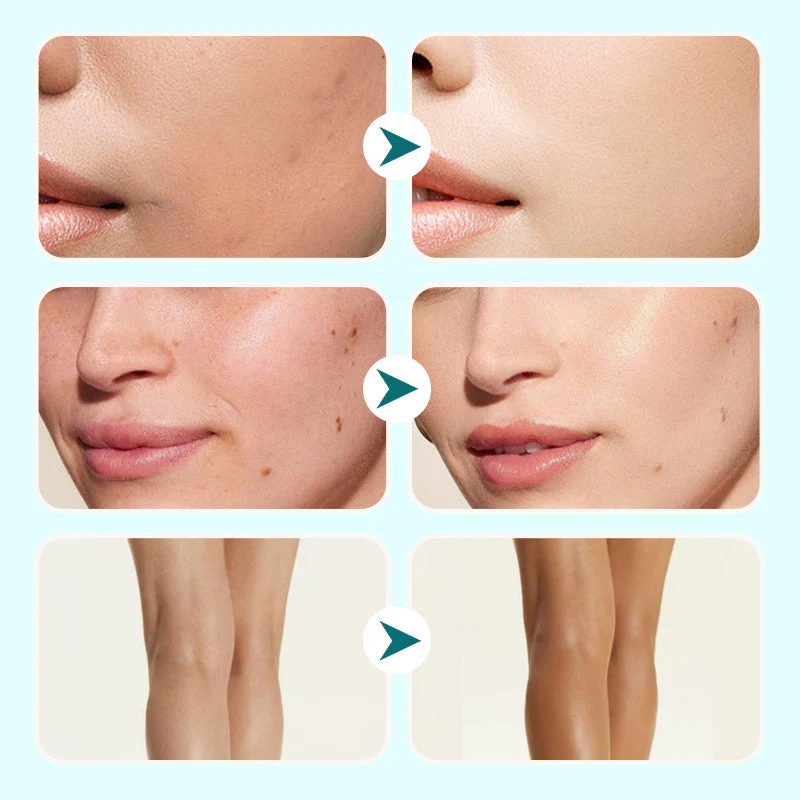 ✨Halloween Early Bird Offer💕Moisturizing Concealer Waterproof Cream For Women - Image 5