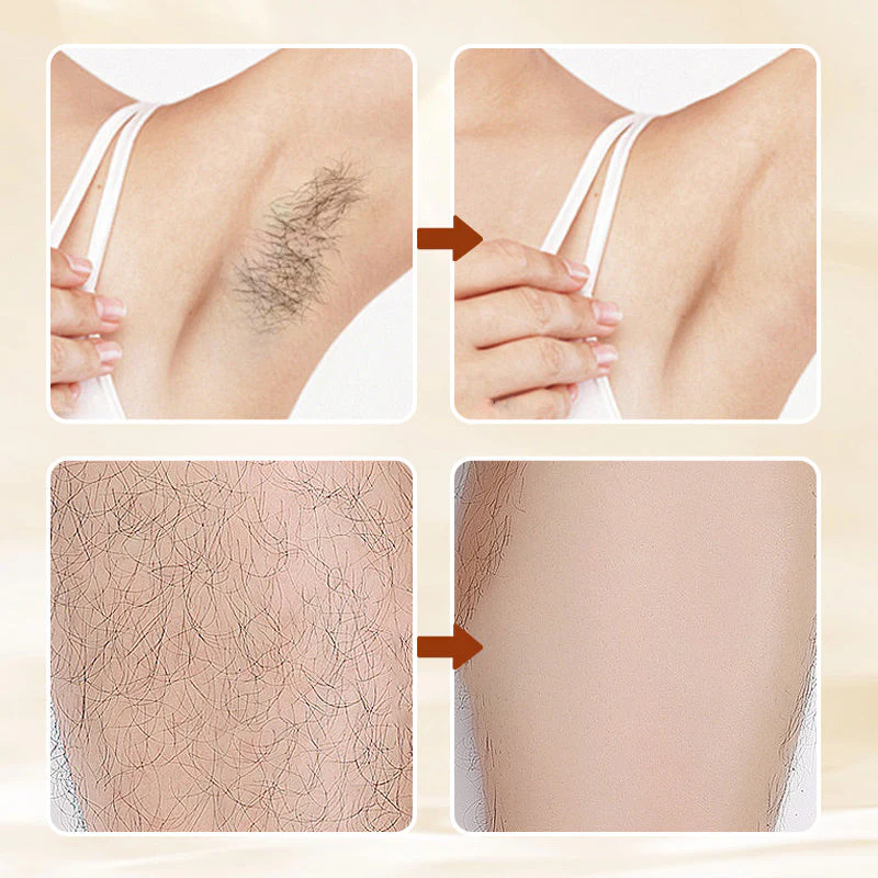 š„HOT SALE 49% OFFš„Versatile Aromatic Hair Removal Cream š„Buy 2 Free Shipping - Image 2