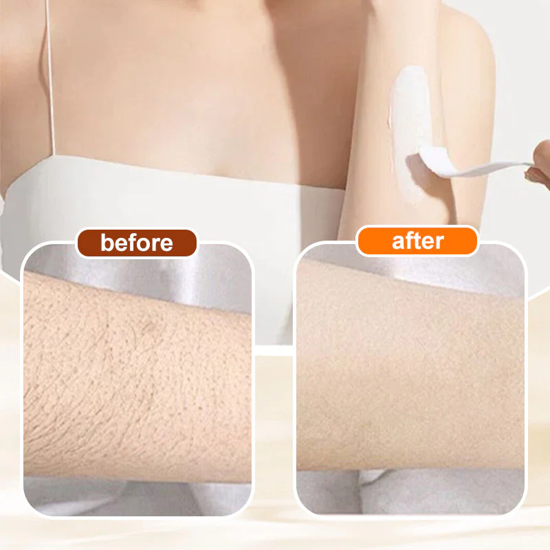 š„HOT SALE 49% OFFš„Versatile Aromatic Hair Removal Cream š„Buy 2 Free Shipping - Image 8