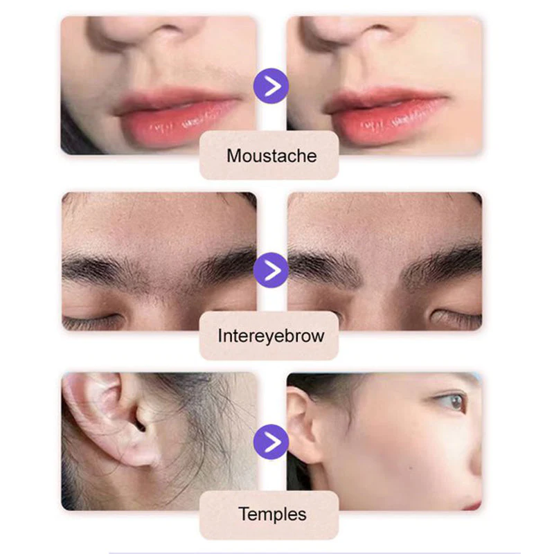 🔥Last Day Special Price £6.99!!💗Buy 2 Get 1 Free🔥 Gentle and Painless Facial Hair Removal Cream - Image 6